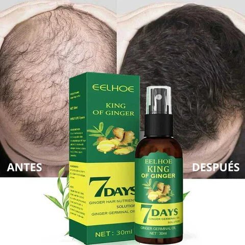Sérum Capilar de Jengibre Anticaída (Esencia Germinal)